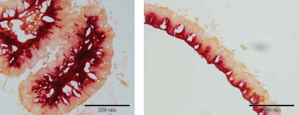 Fig 2: Refacerea citoplasmei cu ajutorul Probioticului Dulcofruct
